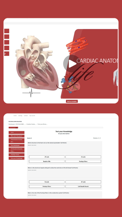 ECG Building Blocks - Online Course